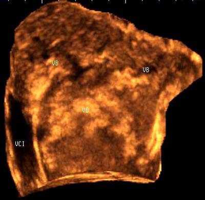 2003 05 02 14 54 24 706