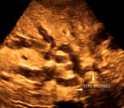 2003 05 02 14 56 16 706