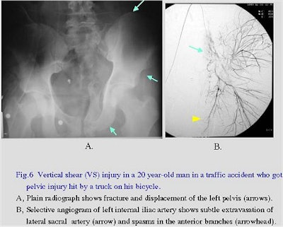 2003 05 02 15 35 09 706