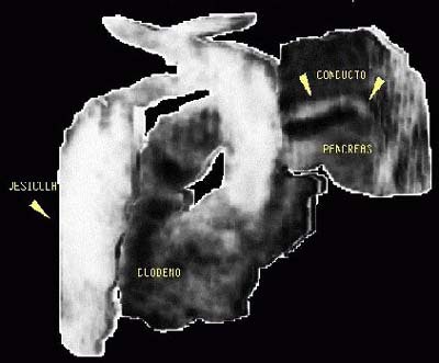 2003 05 02 16 14 16 706