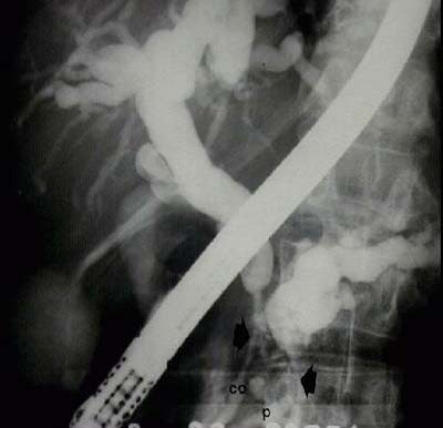 2003 05 02 16 15 05 706