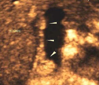 2003 05 02 17 20 24 706