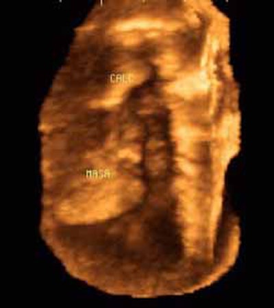 2003 05 04 17 20 28 706