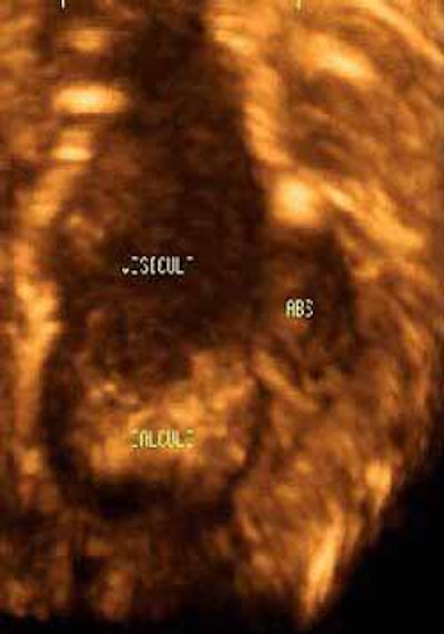 2003 05 04 17 21 23 706