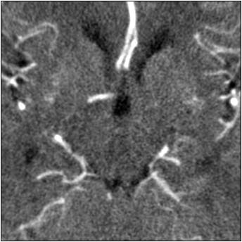 2003 05 16 14 57 00 706