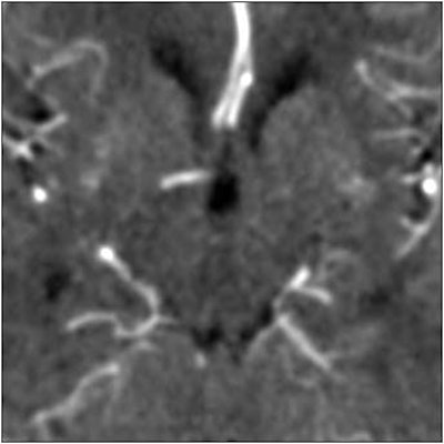 2003 05 16 14 58 52 706