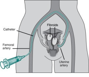 2003 03 31 16 13 26 706