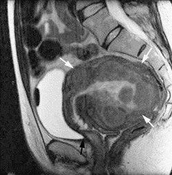 2003 06 06 15 59 24 706