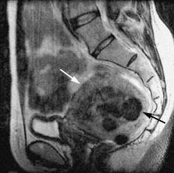 2003 06 06 16 01 38 706