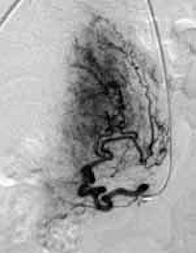 2003 06 06 16 04 13 706