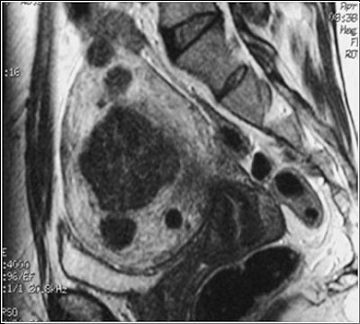 2003 06 06 16 09 53 706