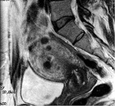 2003 06 06 16 13 18 706