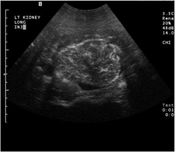 2003 06 16 15 57 13 706