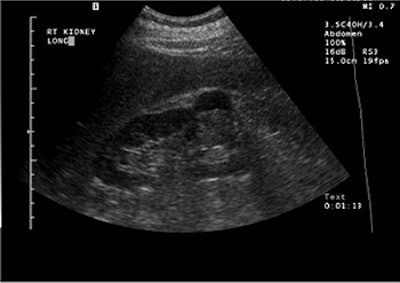 2003 06 16 15 58 35 706