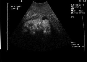 2003 06 16 16 00 36 706