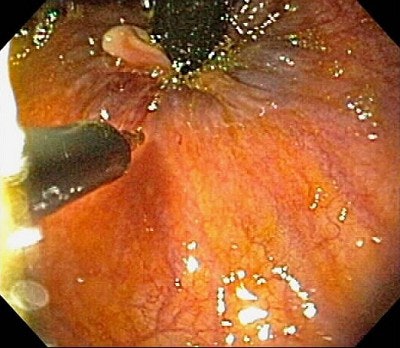 2003 06 19 09 34 35 706