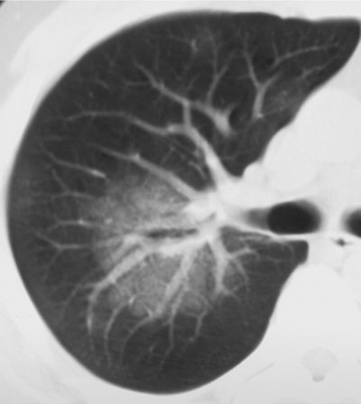 2003 07 03 16 49 30 706