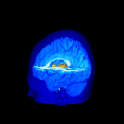 2003 07 07 16 17 32 706