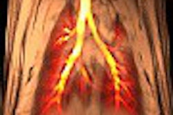 2003 07 18 15 24 52 706