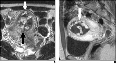 2003 07 31 13 53 42 706