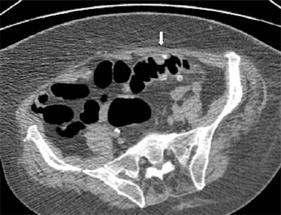 2003 07 31 14 54 56 706