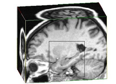 2003 08 04 15 42 15 706