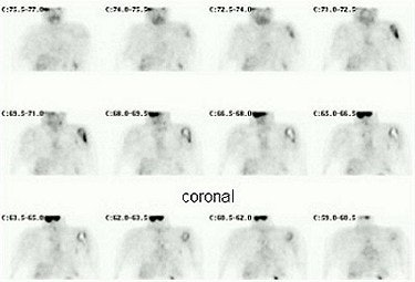 2003 08 15 14 28 34 706