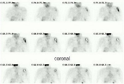 2003 08 15 14 28 34 706