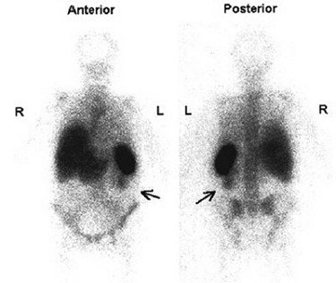 2003 08 15 14 34 06 706