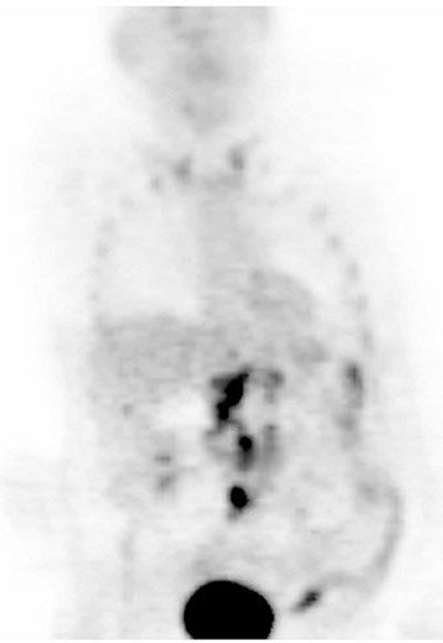 2003 08 15 14 36 16 706