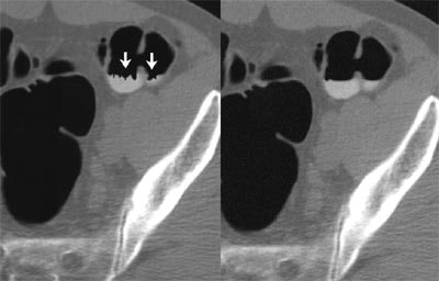 2003 08 29 15 14 43 706