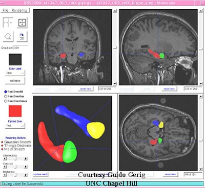2003 09 05 11 11 45 706