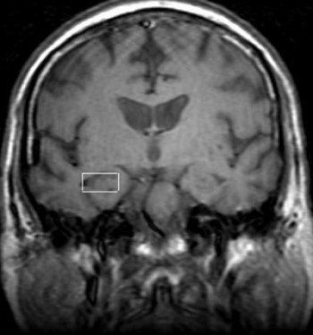 2003 09 08 09 39 54 706