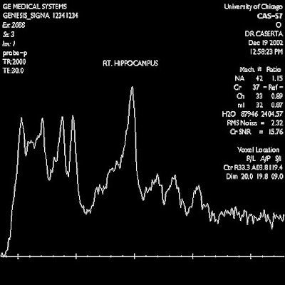 2003 09 08 09 45 30 706