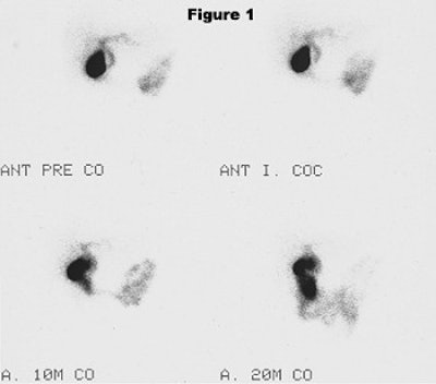 2003 09 26 11 10 17 706