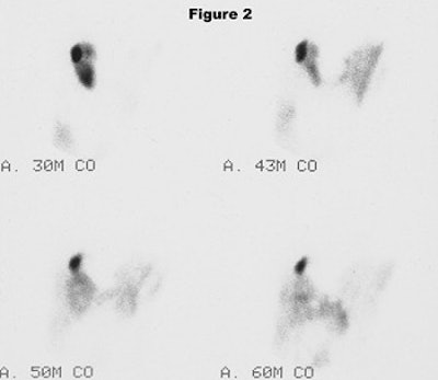 2003 09 26 11 10 45 706