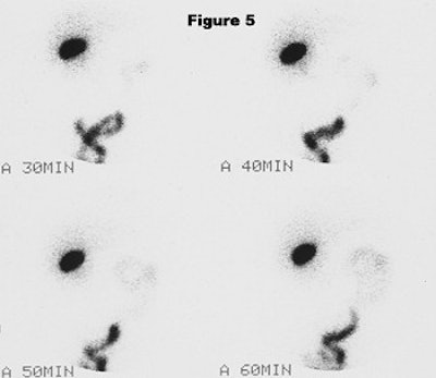 2003 09 26 11 14 49 706