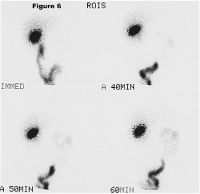 2003 09 26 11 29 11 706