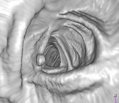 2003 10 03 17 00 46 706