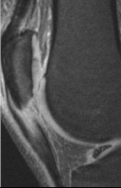 2003 10 07 15 47 19 706