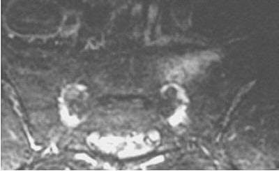 2003 10 07 15 56 44 706