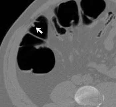 2003 10 14 15 45 05 706