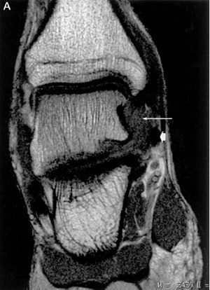 2003 10 28 17 27 19 706