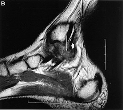 2003 10 28 17 33 35 706