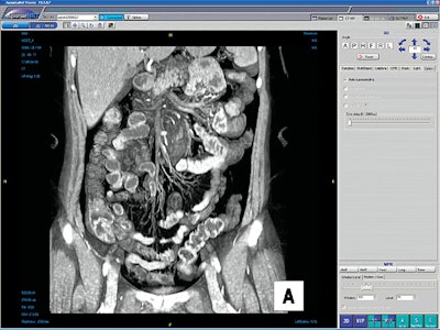 2003 11 03 14 54 28 706