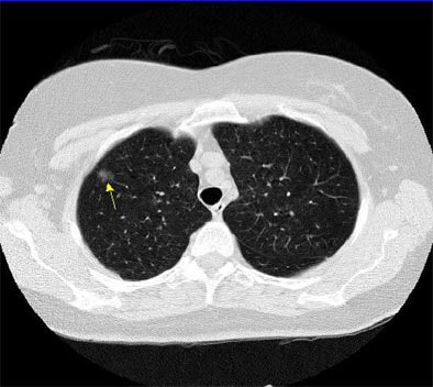 2003 11 13 18 19 08 706