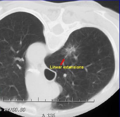 2003 11 13 18 32 19 706