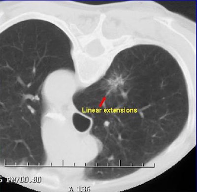 2003 11 13 18 32 19 706