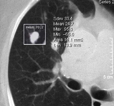 2003 11 13 18 33 17 706