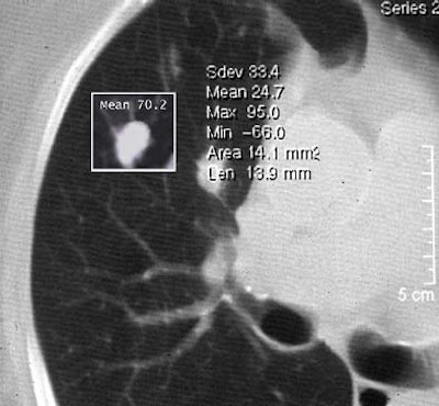 2003 11 13 18 33 17 706